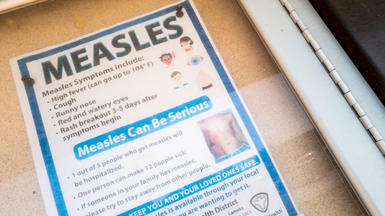 measles-cases-reach-1,024-in-the-us-as-infections-confirmed-in-30-states:-cdc