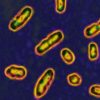 new-mexico-man-diagnosed-with-plague-in-state’s-1st-human-case-this-year:-officials