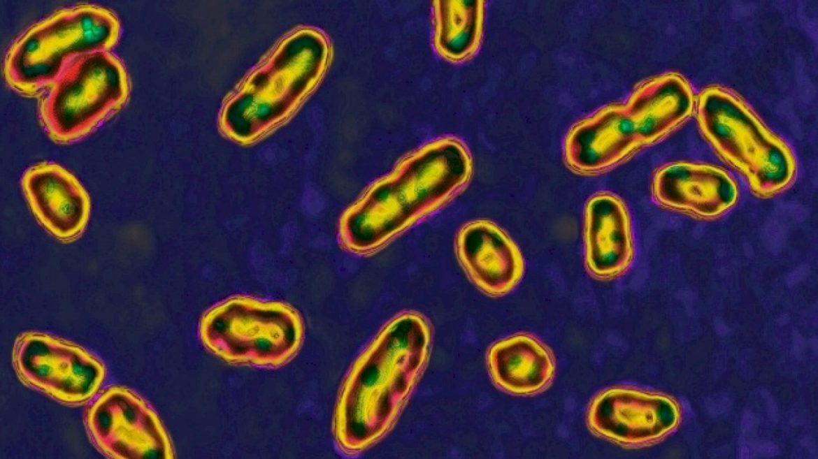new-mexico-man-diagnosed-with-plague-in-state’s-1st-human-case-this-year:-officials