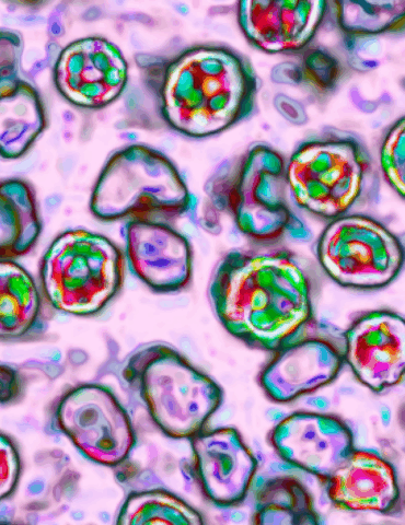 nearly-800-cases-in-south-carolina’s-record-breaking-measles-outbreak