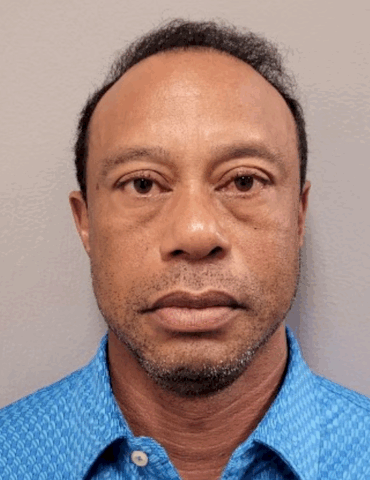 tiger-woods-had-‘bloodshot-and-glassy’-eyes,-‘extremely-dilated’-pupils-after-car-crash:-court-documents