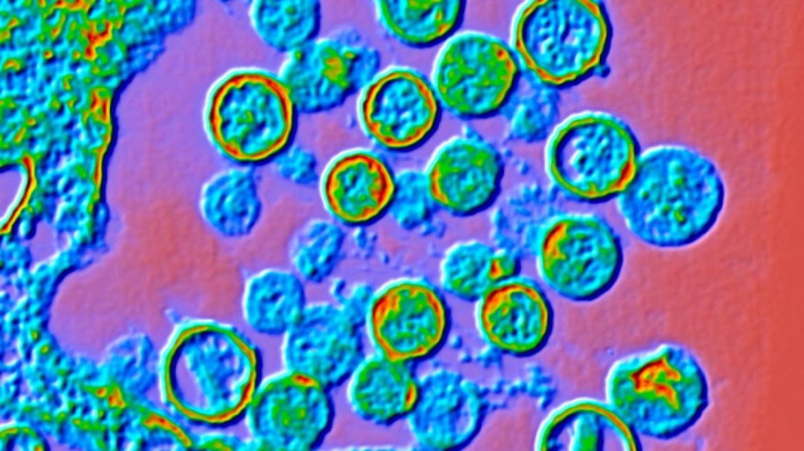 what-to-know-about-a-suspected-hantavirus-outbreak-aboard-a-cruise-ship