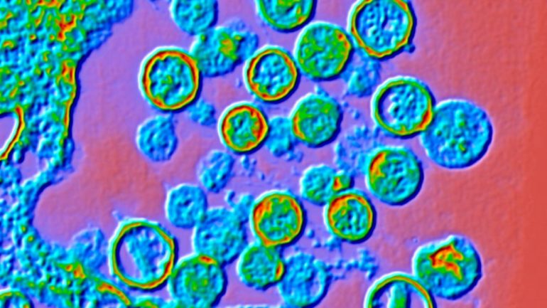 what-to-know-about-a-suspected-hantavirus-outbreak-aboard-a-cruise-ship