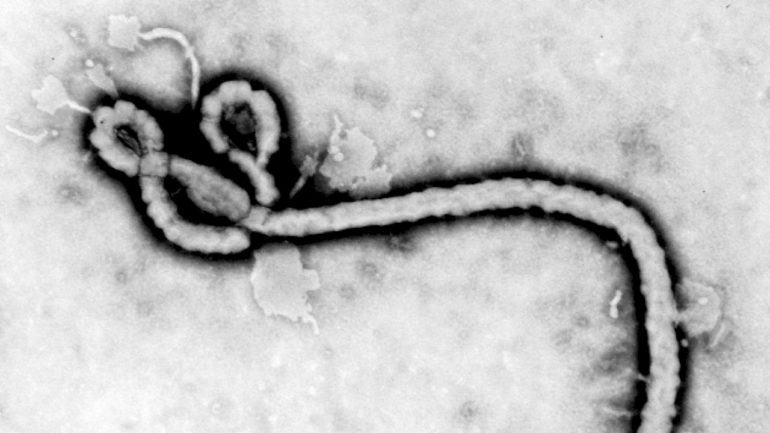 us-doctor-infected-with-ebola-critically-ill-but-says-he-is-‘cautiously-optimistic’