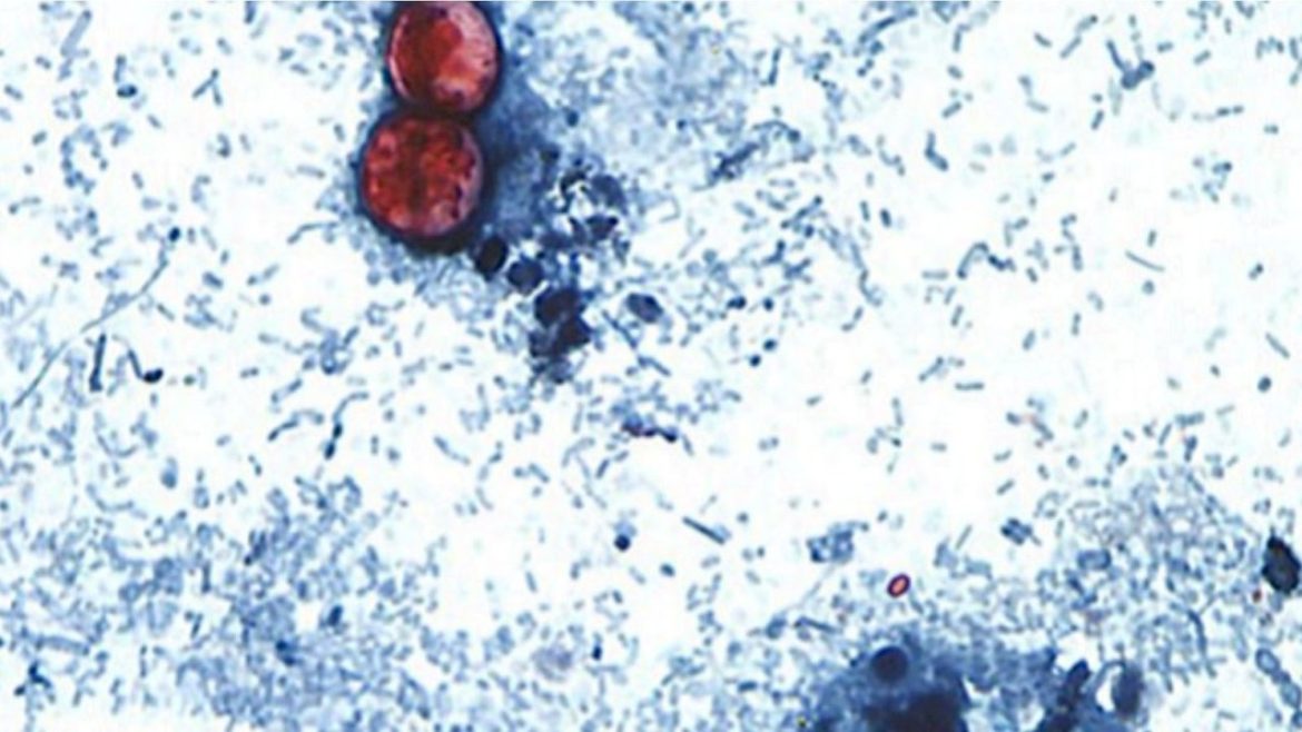 more-than-24,000-cyclosporiasis-infections-reported-as-new-cases-appear-to-slow:-cdc