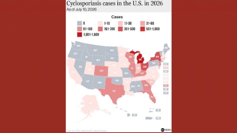 here’s-where-cyclosporiasis-is-spreading-as-cases-are-confirmed-in-32-states
