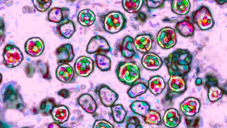 pennsylvania-surpasses-900-measles-cases-with-13-new-confirmed-infections:-officials